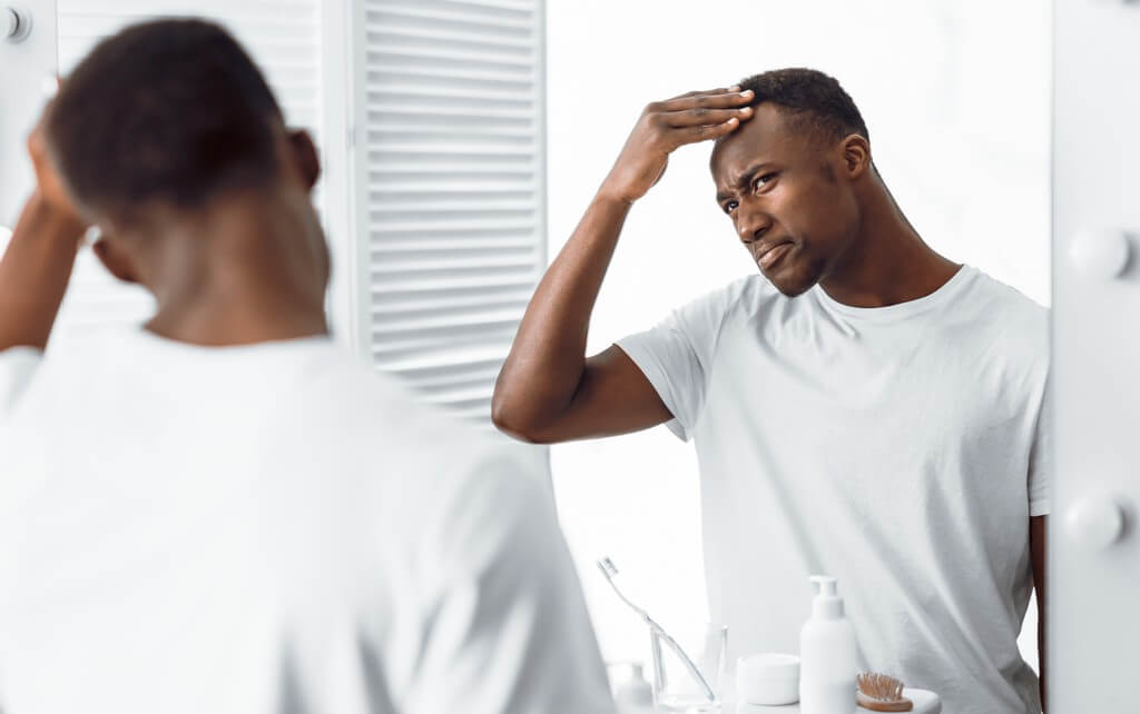 Hair loss: Causes of hair fall in men  hair loss - Hair loss Causes of hair fall in men 2 - Hair loss: Causes of hair fall in men 