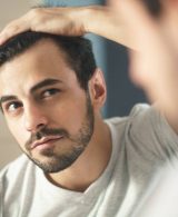 Hair loss: Causes of hair fall in men