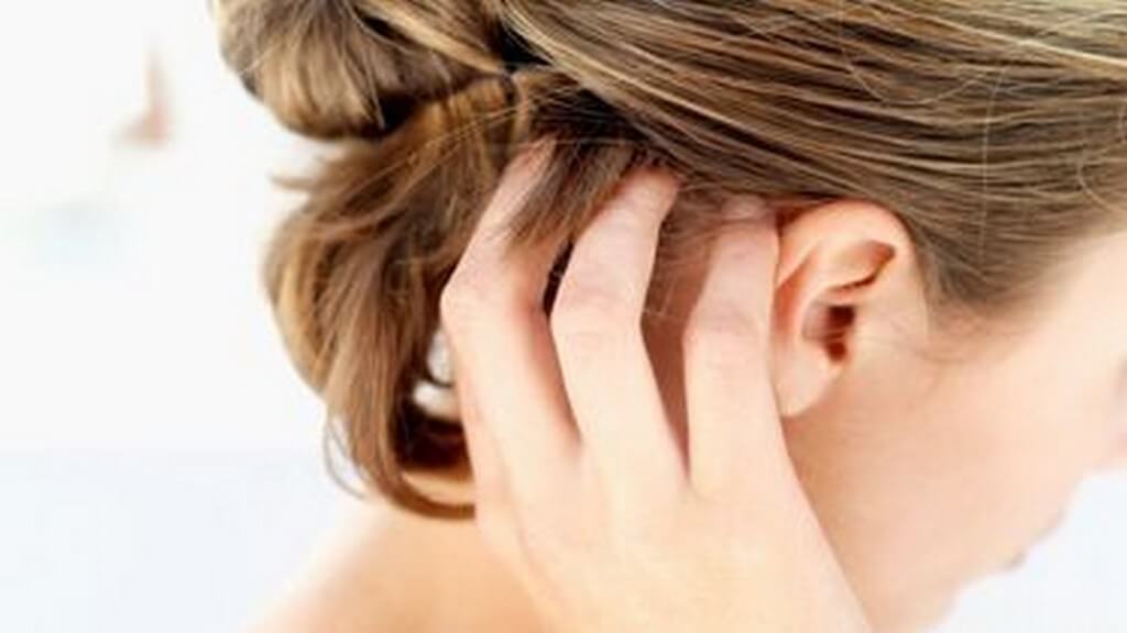 Scalp psoriasis: Effective home remedies for relief scalp psoriasis - Scalp psoriasis Effective home remedies for relief Thumbnail - Scalp psoriasis: Effective home remedies for relief 