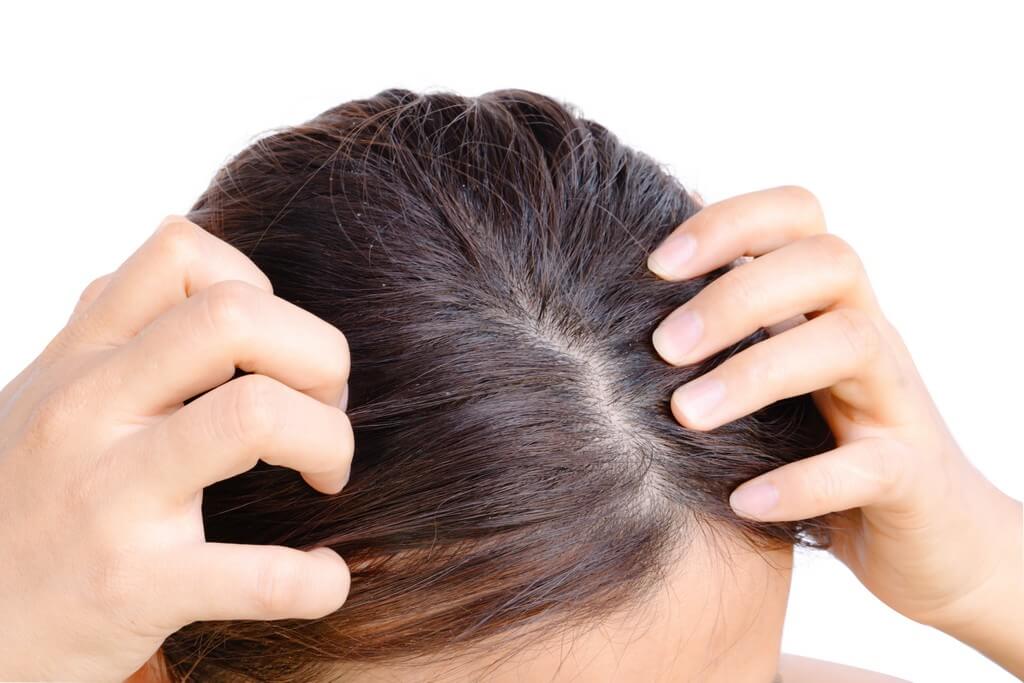 Hair loss: Causes of hair fall in women hair loss - Hair loss Causes of hair fall in women 1 - Hair loss: Causes of hair fall in women 