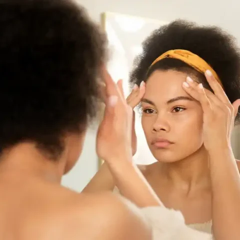 Monsoon skincare for acne: 5 mantras to stay acne-free this season